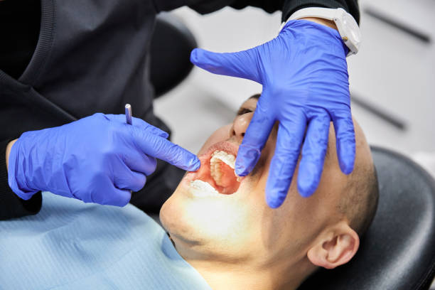 Best Emergency Dental Care for Broken or Chipped Teeth in Crystal River, FL