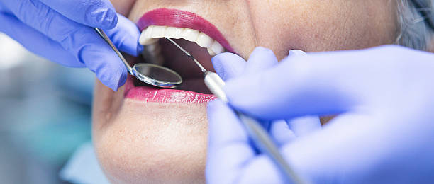 Best Emergency Dental Care for Broken or Chipped Teeth in Crystal River, FL